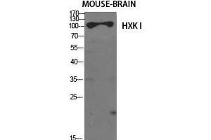 Western Blot (WB) analysis of specific cells using HXK I Polyclonal Antibody. (HXK I (N-Term) anticorps)