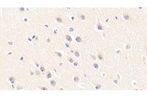 Detection of SIRT3 in Human Cerebrum Tissue using Polyclonal Antibody to Sirtuin 3 (SIRT3)