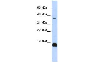 WB Suggested Anti-TAC3 Antibody Titration:  0. (Tachykinin 3 anticorps  (Middle Region))