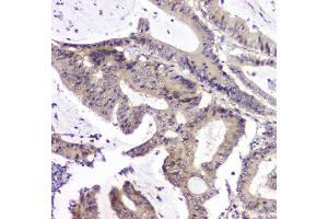 IHC analysis of PPCS using anti-PPCS antibody (ABIN6719631). (PPCS anticorps)