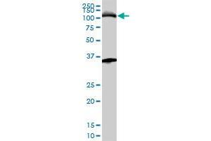 MCM3 monoclonal antibody (M01A), clone 4F7. (MCM3 anticorps  (AA 699-808))