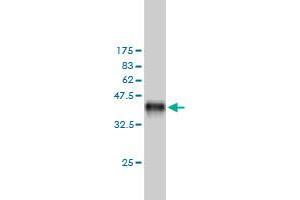 Western Blot detection against Immunogen (37.