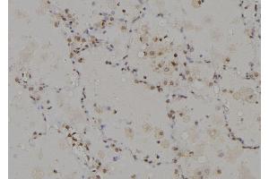 ABIN6274946 at 1/100 staining Human lung tissue by IHC-P. (CAGE1 anticorps  (C-Term))