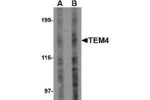 Western blot analysis of TEM4 in Jurkat Cell lysate with TEM4 antibody at (A) 1 and (B) 2 µg/ml. (ARHGEF17 anticorps)