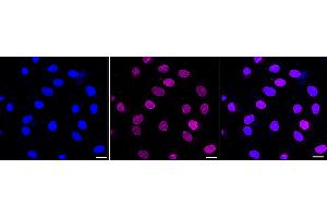 Immunocytochemical staining of HT- cells with EPH receptor B1 antibody (ABIN7798455), 1:1,000). (Recombinant EPH Receptor B1 anticorps)