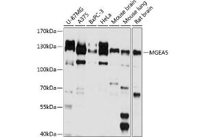 Western blot analysis of extracts of various cell lines, using MGE antibody (ABIN6132799, ABIN6143821, ABIN6143822 and ABIN6224867) at 1:1000 dilution. (MGEA5 anticorps  (AA 380-580))