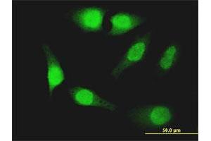 Immunofluorescence of monoclonal antibody to FOXO1 on HeLa cell. (FOXO1 anticorps  (AA 452-555))