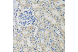 Immunohistochemistry of paraffin-embedded rat kidney using CCL26 antibody at dilution of 1:200 (40x lens). (CCL26 anticorps)