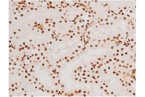 ABIN6267523 at 1/200 staining Rat kidney tissue sections by IHC-P.