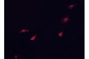 ABIN6268866 staining HeLa cells by IF/ICC. (Glucagon Receptor anticorps  (Internal Region))