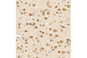 Immunohistochemistry of paraffin embedded rat brain using UBE3A (ABIN7076105) at dilution of 1:500 (400x lens)