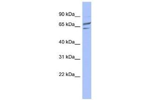 PGM1 antibody used at 1 ug/ml to detect target protein.
