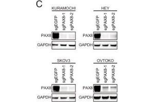 The PAX8-FGF18 signaling axis promotes tumor cell motility.