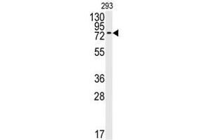 Image no. 1 for anti-Bone Morphogenetic Protein Receptor 1A (BMPR1A) (N-Term) antibody (ABIN357374) (BMPR1A anticorps  (N-Term))
