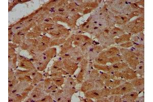 IHC image of ABIN7148294 diluted at 1:500 and staining in paraffin-embedded human heart tissue performed on a Leica BondTM system.