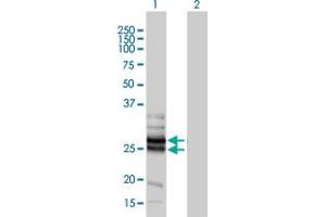 Western Blot analysis of GJB4 expression in transfected 293T cell line by GJB4 monoclonal antibody (M01), clone 1E3-1C12.