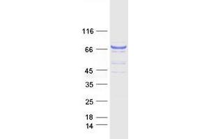 Validation with Western Blot