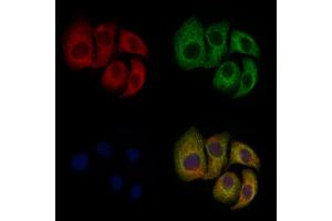ABIN6257117 and ABIN6275043 staining Hela cells by IF/ICC. (GARP anticorps  (Internal Region))