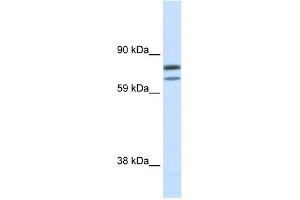 WB Suggested Anti-ZFPM1 Antibody Titration:  0.