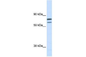WB Suggested Anti-ZFPM1 Antibody Titration:  0. (ZFPM1 anticorps  (N-Term))