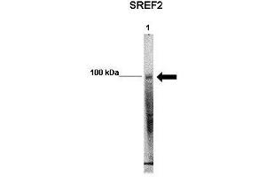 WB Suggested Anti-SREBF2 Antibody    Positive Control:  Lane 1: 50ug mouse glomerular endothelial lysate   Primary Antibody Dilution :   1:1000   Secondary Antibody :  Anti-rabbit-HRP   Secondry Antibody Dilution :   1:5000   Submitted by:  Xiaoxin Wang, UC Denver (SREBF2 anticorps  (Middle Region))