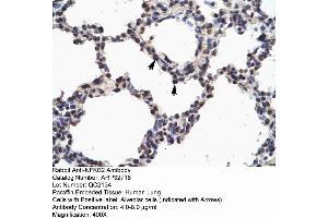 Human Lung (NFKB2 anticorps  (N-Term))