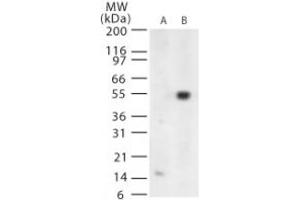 Image no. 1 for anti-West Nile Virus (WNV) (AA 73-86) antibody (ABIN199990) (West Nile Virus anticorps  (AA 73-86))