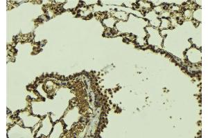 ABIN6268967 at 1/100 staining Mouse lung tissue by IHC-P. (DAXX anticorps  (C-Term))