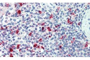 Detection of TREM2 in Human Spleen Tissue using Polyclonal Antibody to Triggering Receptor Expressed On Myeloid Cells 2 (TREM2)