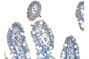 SLC22A1 antibody was used for immunohistochemistry at a concentration of 4-8 ug/ml to stain Epithelial cells of intestinal villus (arrows) in Human Intestine.