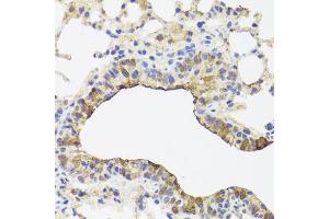 Immunohistochemistry of paraffin-embedded mouse lung using TOMM34 antibody (ABIN5972523) at dilution of 1/100 (40x lens). (TOMM34 anticorps)