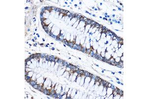 Immunohistochemistry of paraffin-embedded Human colon using C Rabbit pAb (ABIN3022800, ABIN3022801, ABIN3022802 and ABIN6219234) at dilution of 1:50 (40x lens).