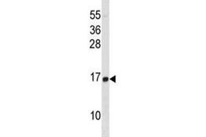 HIST1H2BD antibody western blot analysis in HL-60 lysate.