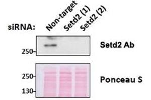 Western blot testing of mouse fibroblast lysates transiently expressing unrelated and two different siRNA with SETD2 antibody at 0. (SETD2 anticorps)