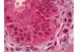 Anti-PAX9 antibody IHC of human uterus, endometrium.