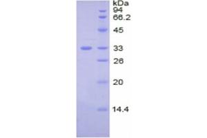 SDS-PAGE of Protein Standard from the Kit (Highly purified E. (Ceruloplasmin Kit CLIA)