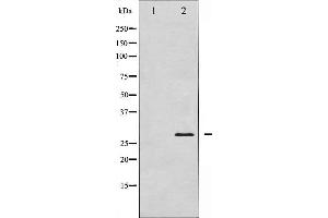Western blot analysis of TNNI3 expression in Mouse hearttissue lysates,The lane on the left is treated with the antigen-specific peptide. (TNNI3 anticorps)