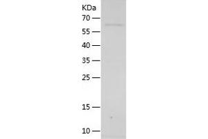 Western Blotting (WB) image for Dopamine beta-Hydroxylase (Dopamine beta-Monooxygenase) (DBH) (AA 40-617) protein (His tag) (ABIN7122701)