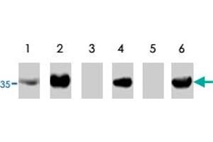 Western blot using TP53I3 polyclonal antibody  on RKO cells transfected with TP53I3 without insert (lane 1), transfected with pCEP4-TP53I3 (lane 2), under control conditions (lane3) and treated with adriamycin to activate wild-type p53 (lane 4). (TP53I3 anticorps)