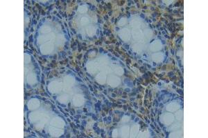 Used in DAB staining on fromalin fixed paraffin- embedded rectum tissue (TCEB1 anticorps  (AA 1-112))