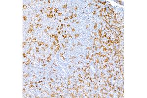 Immunohistochemistry (IHC) image for anti-Integrin, alpha X (Complement Component 3 Receptor 4 Subunit) (ITGAX) (AA 112-355) antibody (ABIN7449422)