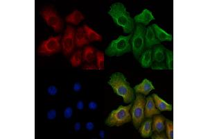 ABIN6256027 and ABIN6267368 staining H2O2 treated Hela cells by IF/ICC.