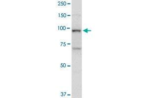 TOP1 monoclonal antibody (M01), clone 1A1. (Topoisomerase I anticorps  (AA 692-765))