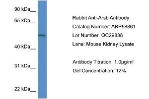 Western Blotting (WB) image for anti-Arylsulfatase B (ARSB) (Middle Region) antibody (ABIN786015) (Arylsulfatase B anticorps  (Middle Region))