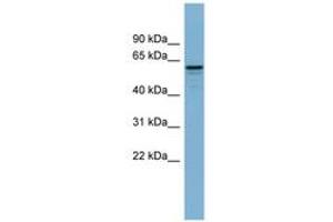 Image no. 1 for anti-Dynactin 4 (DCTN4) (AA 71-120) antibody (ABIN6741902) (Dynactin 4 anticorps  (AA 71-120))