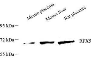 Western blot analysis of RFX5 (ABIN7075399),at dilution of 1: 1500 (RFX5 anticorps)