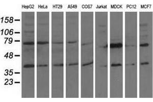 Western blot analysis of extracts (35 µg) from 9 different cell lines by using anti-CBWD1 monoclonal antibody. (CBWD1 anticorps)