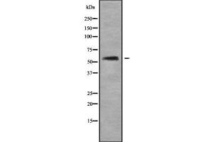 Western blot analysis of AGXT2 using COLO205 whole cell lysates (AGXT2 anticorps  (Internal Region))