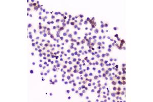 IHC analysis of CD11a using anti-CD11a antibody (ABIN5518766). (ITGAL anticorps  (AA 161-349))