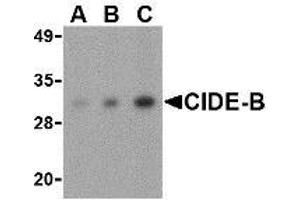 Western blot analysis of CIDE-B in mouse small intestine tissue lysate with AP30233PU-N CIDE-B antibody at (A) 0. (CIDEB anticorps  (Center))